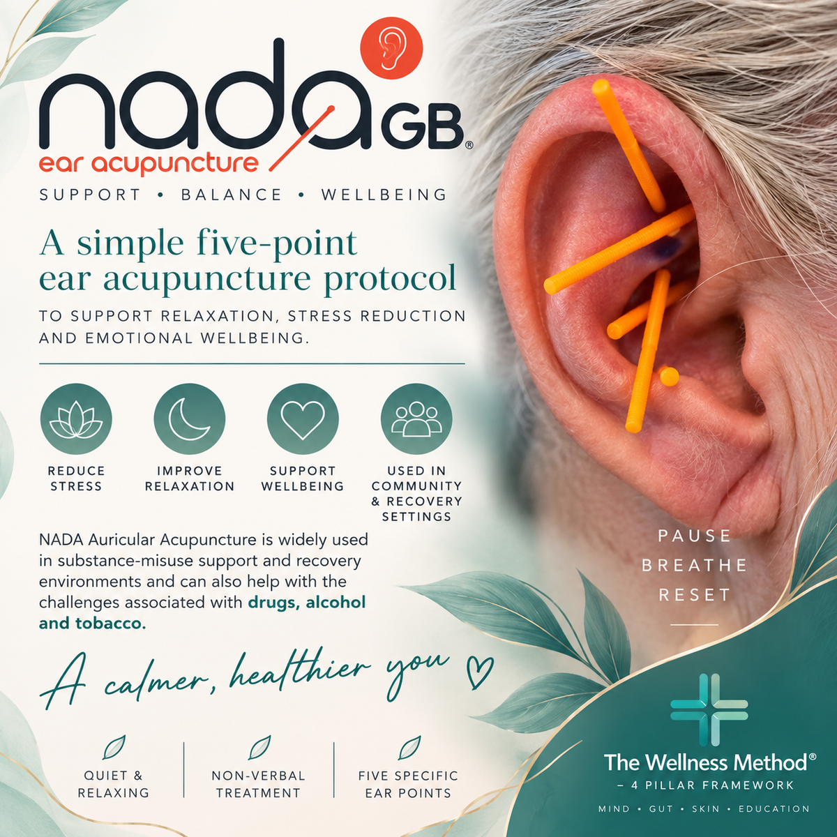 NADA GB Auricular Acupuncture — £35 - Optional to go home with ear seed