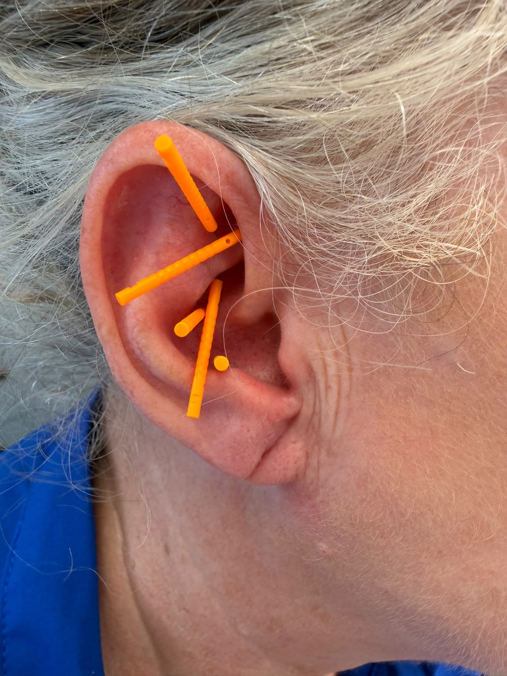 NADA GB Auricular Acupuncture — £35 - Optional to go home with ear seed