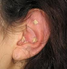 NADA GB Auricular Acupuncture — £35 - Optional to go home with ear seed