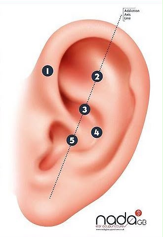 9D Breathwork & NADA Ear Seed Experience | £35 - St Matthews Wellness Centre - 7th Nov 11am